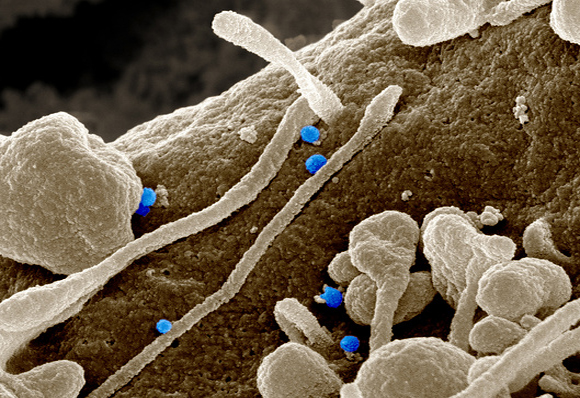 ​המחלה לא מועברת ישירות בין בני אדם, לפחות בינתיים. צילום במיקרוסקופ אלקטרונים של נגיפי קדחת קרים-קונגו (צבועים בכחול) | מקור: NATIONAL INSTITUTE OF ALLERGY AND INFECTIOUS DISEASES, NATIONAL INSTITUTES OF HEALTH / SCIENCE PHOTO LIBRARY