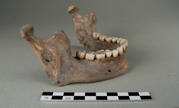 לסת עם סימנים לזיהום בחיידק | צילום: Kati Salo / Finnish Heritage Agency