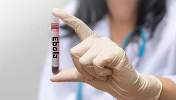 עדיין אין חיסון נגד נגיף סודן שגורם לאבולה, הניסוי החדש עשוי להיות צעד חשוב בכיוון. מבחנה עם דם נגוע באבולה | צילום אילוסטרציה: BlurryMe, Shutterstock