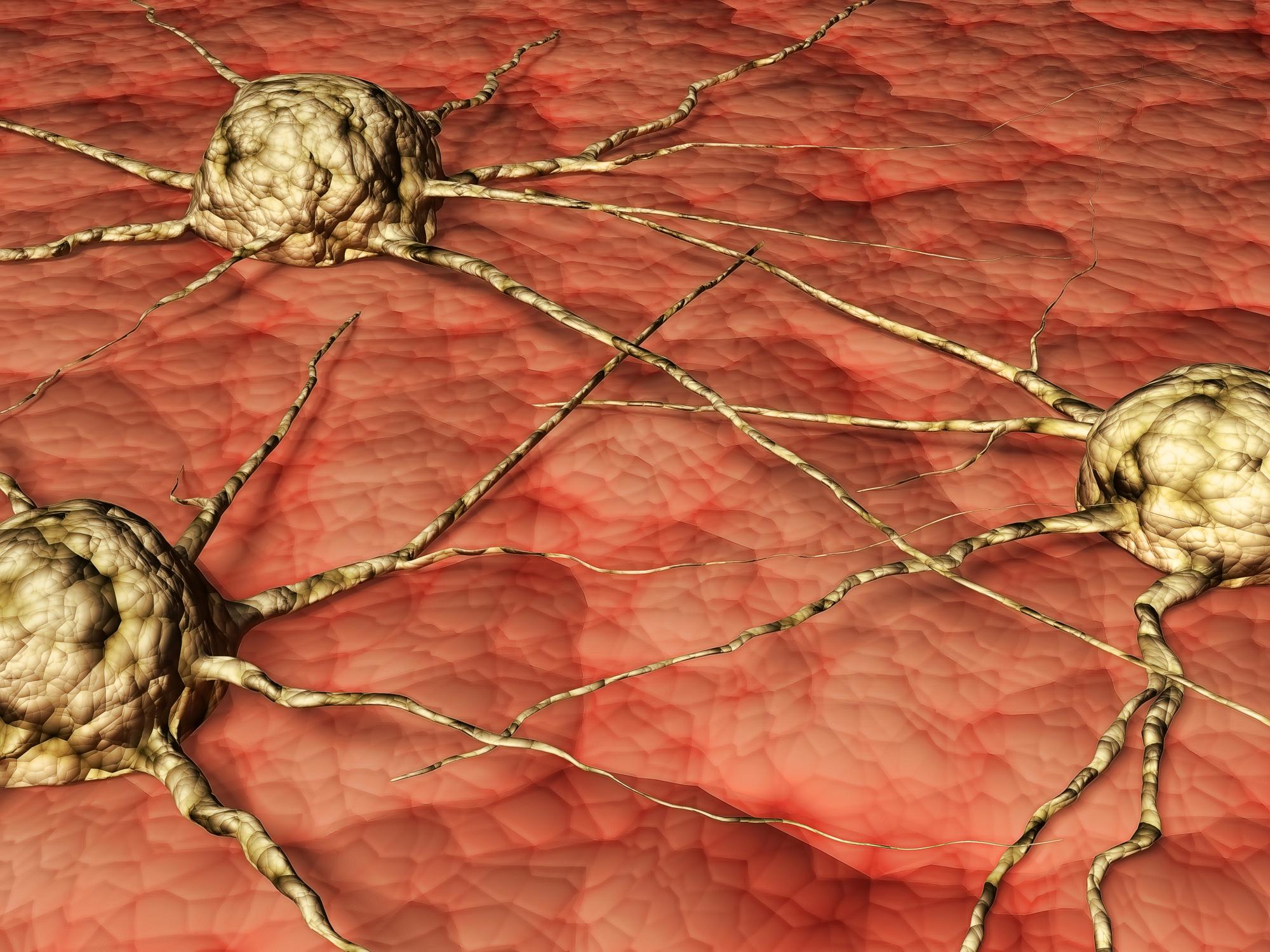 סרטן הערמונית