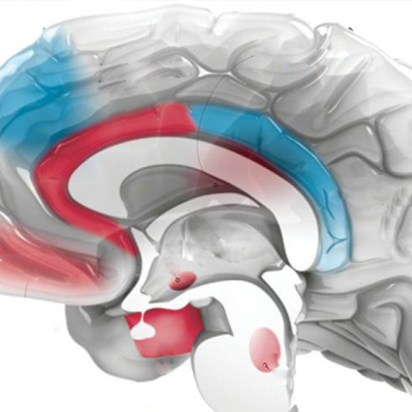 רצח מתוך שינה
