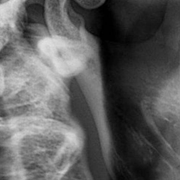 מכונת הרנטגן המופלאה