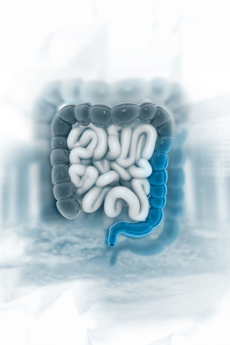 לאבחן בזמן את סרטן המעי הגס