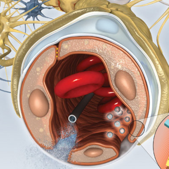 לפרוץ את הדרך אל המוח