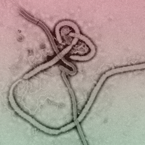 האם נמצאה תרופה לאבולה?