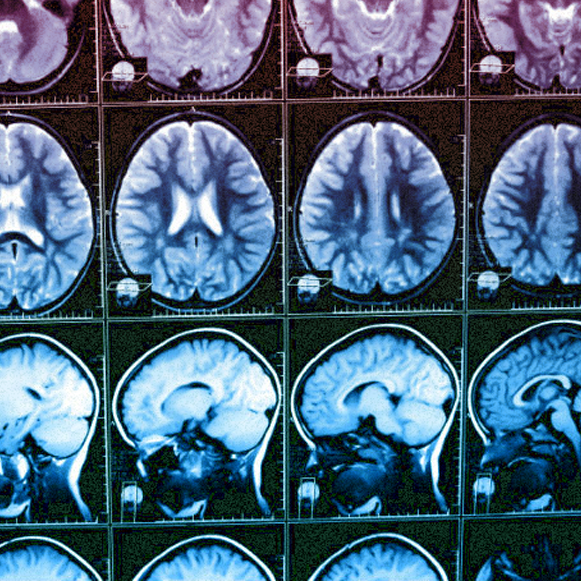 מדע בדקה: מחקר הדימות הגדול בעולם