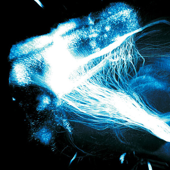 מבט אל תוך המוח השקוף