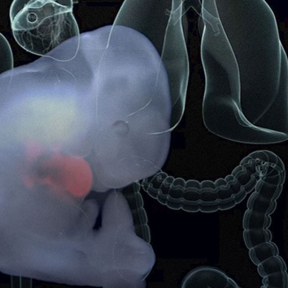 לגדל אדם בתוך חזיר