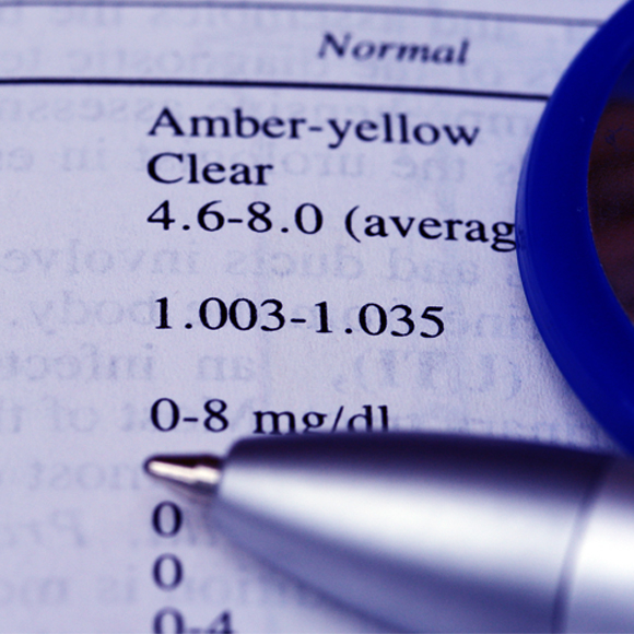 ما هو الوزن النّوعيّ؟