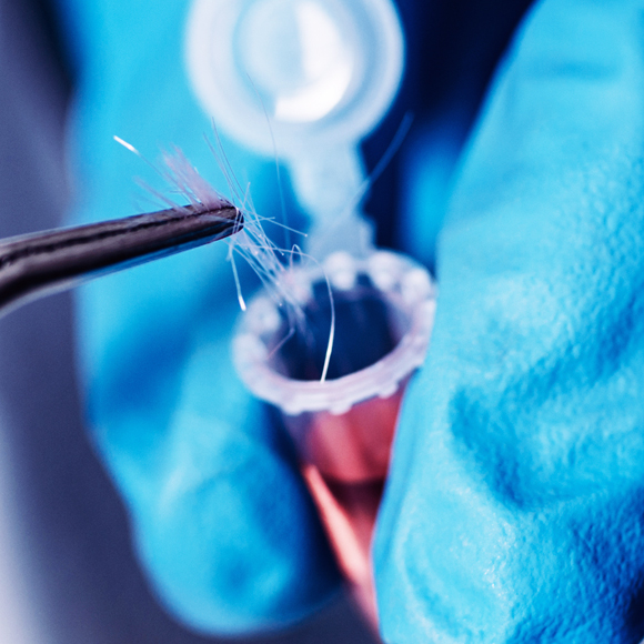 DNA Hanging by a Hair