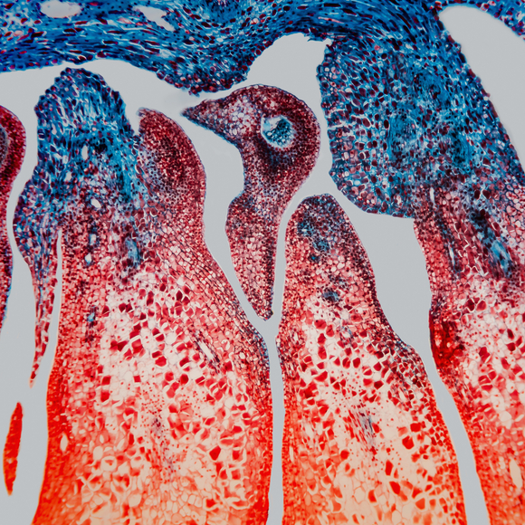 الأنيبيبات الدقيقة – أعمدة الارتكاز في الخليّة