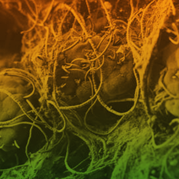 חיידקים ידידותיים שולחים מסר למערכת החיסון