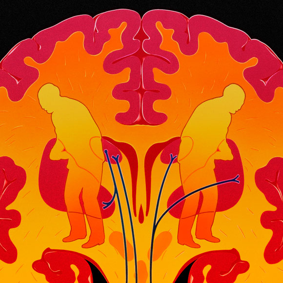 Parkinson’s Disease: Catching the Early—and small—Signs