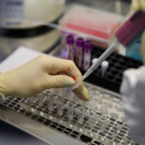 جائحة الكورونا: هل نحن بصدد فحوص سريعة وقليلة التكلفة؟