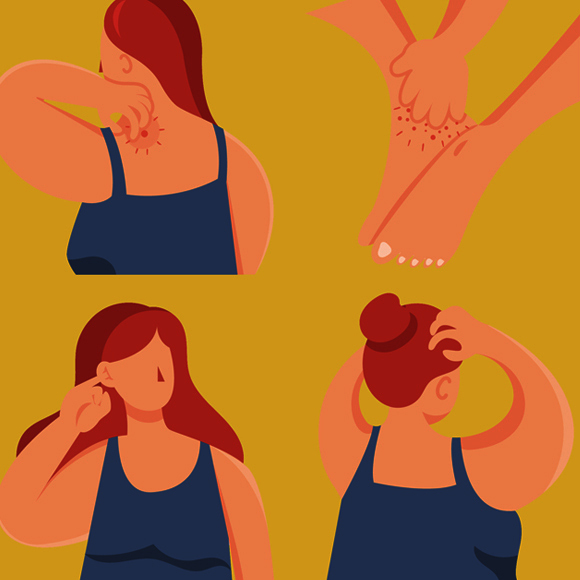 يا إلهي، إنّه مثير للحَكّ!