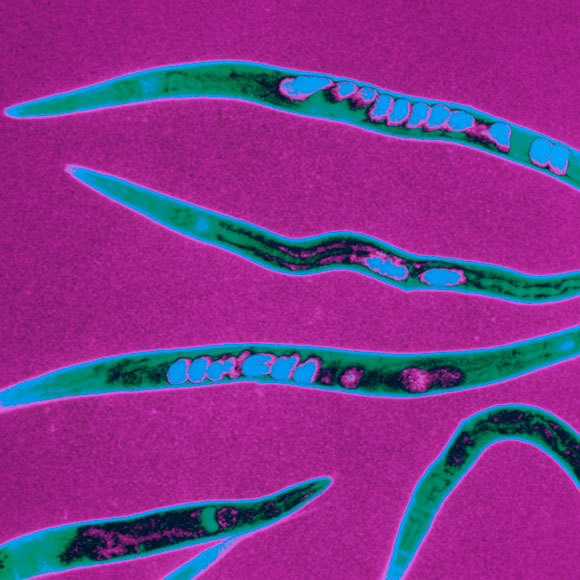 התולעת שעוקפת את הנזק המוחי