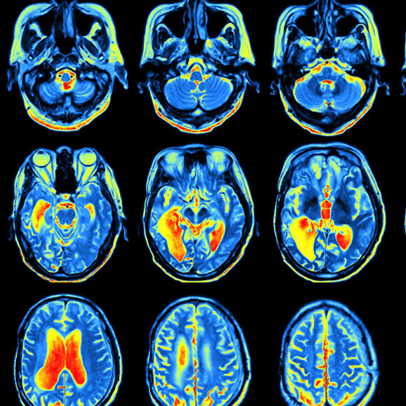Medical Imaging Technologies – Seeing the Invisible