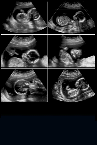 הרופא שראה את הנולד