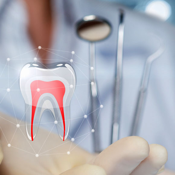 צבא הננובוטים של רופאי השיניים