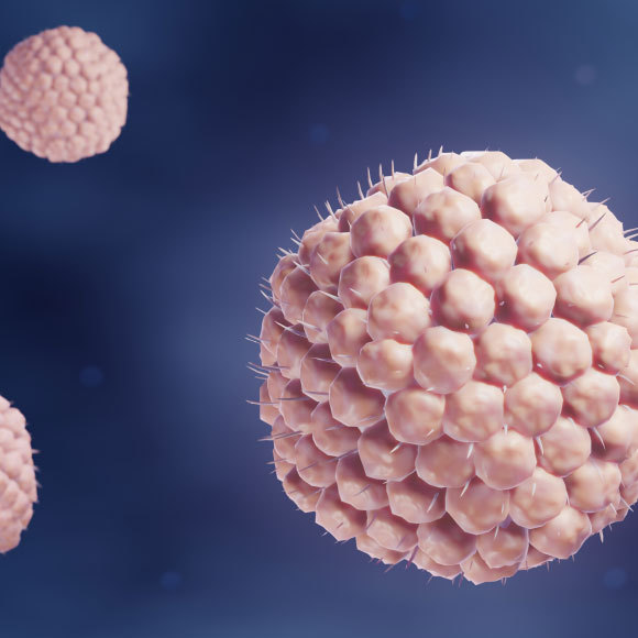 מהי תסמונת רמזי-האנט?