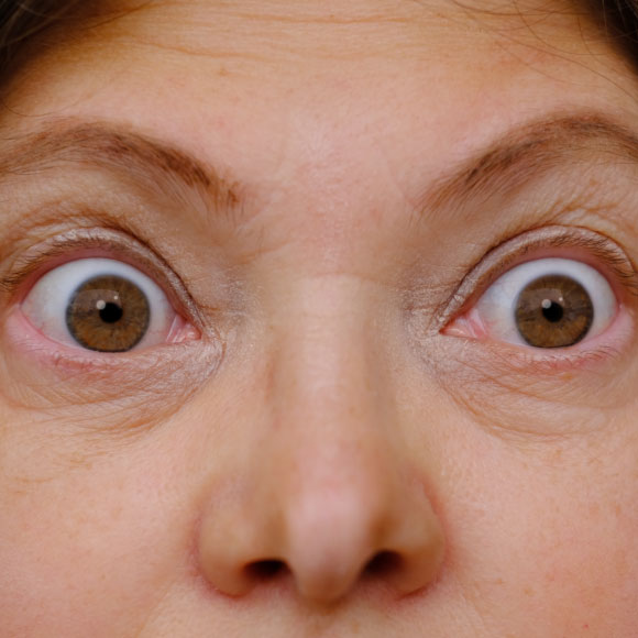 Understanding the Fight or Flight Response