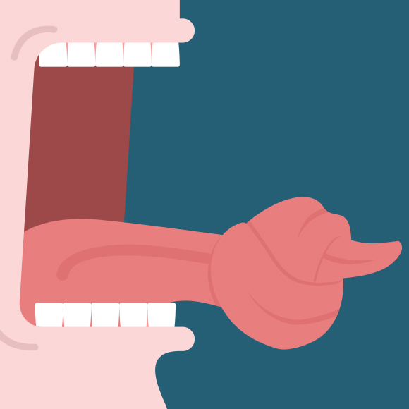 ظاهرة التصاق اللّسان