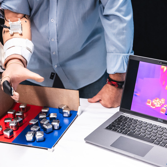 الإحساس بالحرارة في يد اصطناعية