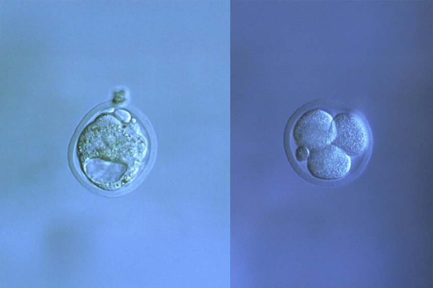 היכולת לעקוב אחרי כל תא בנפרד אובדת בתוך זמן קצר. מימין: עובר של עכבר אחרי שתי חלוקות לארבעה תאים זהים; משמאל: צביר תאים ראשוני (בלסטוציסט) | David Spears Ltd / Science Photo Library