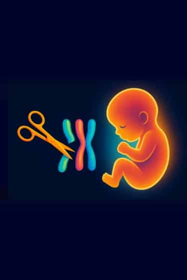 לחתוך החוצה את תסמונת דאון