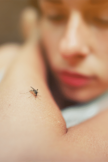 מחלות ללא גבולות: חצבת ומלריה