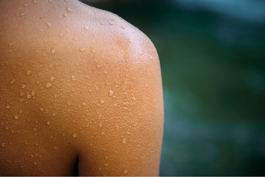 בניגוד למה שסברו עד כה, הזיעה היא לא מופרשת בטיפות. כתף מזיעה | Shutterstock, Kate Stock