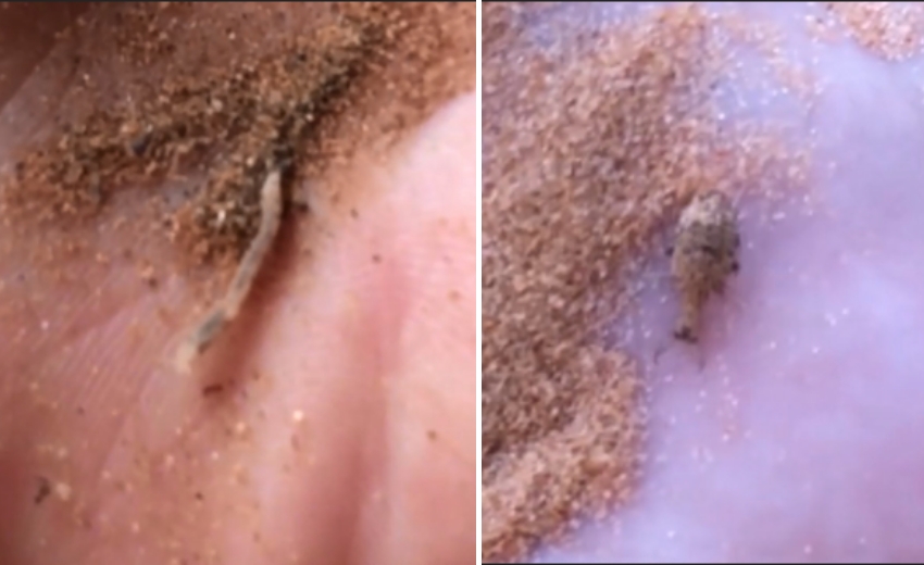 הזחל הוא שבונה את הגומות וצד נמלים. זחלים של ארינמל (ימין) וארי-תולע (שמאל) על כף היד. אפשר להבחין במלתעותיו האימתניות של הארינמל | צילום: אבי סאייג