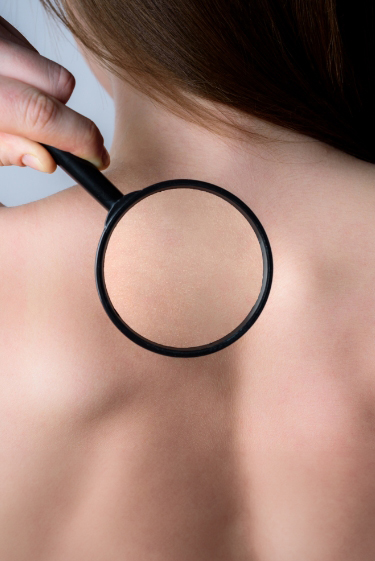 האם העור באמת “נושם”?