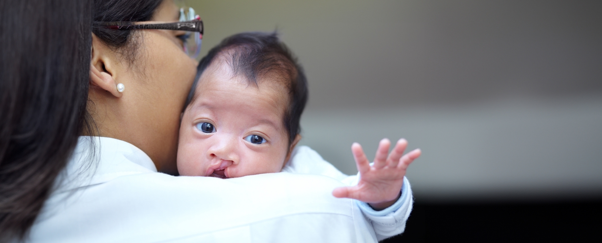 What Causes Cleft Lip and Palate? A Genetic Clue Emerges