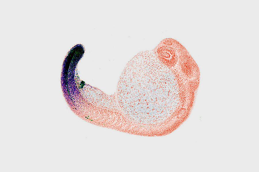 המערכת התורשתית שאחראית על התפתחות האצבעות בגפיהם של יצורים בעלי ארבע גפיים מוחזרה ממערכת קדומה יותר שממנה התפתח פתח הביב. עובר של דג זברה (פתח הביב מסומן כנקודה בשחור) | מקור: © Brent Hawkins, Harvard