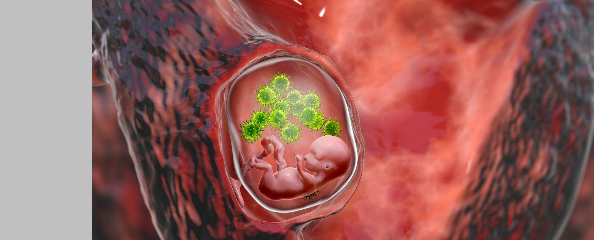 עובר ונגיפי ציטומגלו בתוך הרחם | איור: Kateryna Kon, Shutterstock