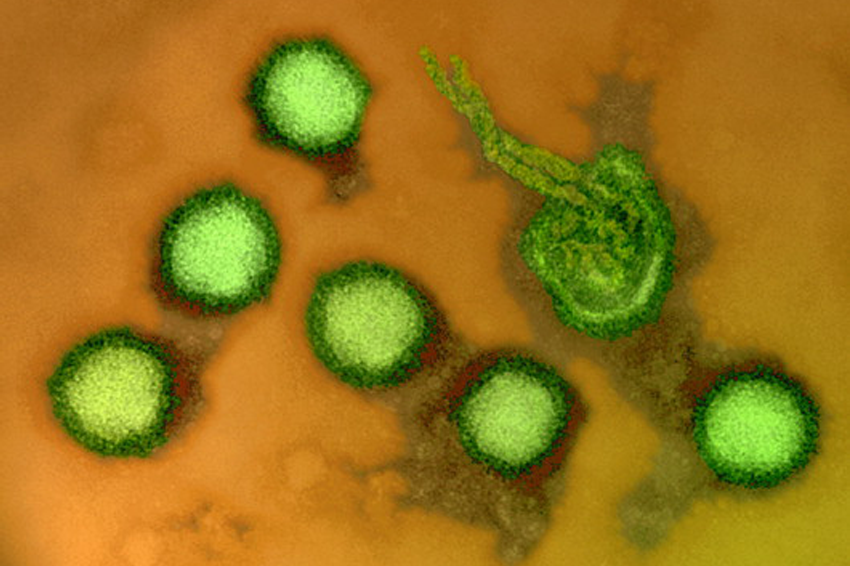 בסנגל נמשכת התפרצות קדחת השקע האפריקאי. תמונת מיקרוסקופ אלקטרונים סורק של חלקיקי הנגיף הגורם למחלה | Dr Linda Stannard, UCT / Science Photo Library