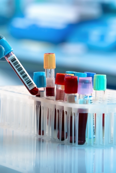 מחלות ללא גבולות: עלייה בתחלואת השפעת