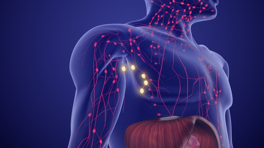 כשמדובר בקעקועים שגודלם עולה על גודל כף היד, הסיכון לפתח לימפומה עולה בכ-170 אחוז. קשרי לימפה | JitendraJadhav, Shutterstock