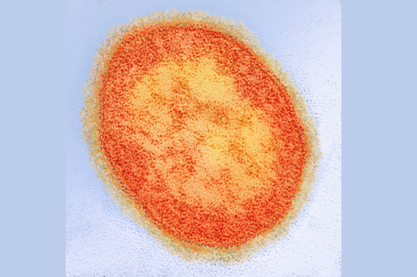 החצבת כעת היא בעיה עולמית חמורה. נגיף חצבת | Ami Images / Science Photo Library