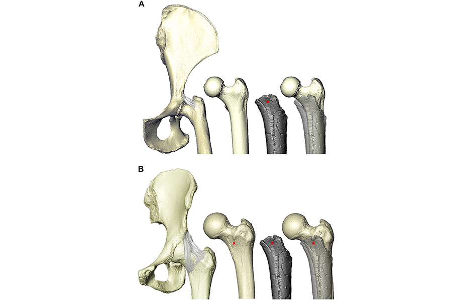 השוואת מבנה עצם הירך בין (A) שימפנזה (עצם בהירה שנייה משמאל) לזו של סהלאנתרופוס צ'אדנסיס (באפור), ובין (B) אדם לסהלאנתרופוס צ'אדנסיס. הבליטה הקטנה בעצם הירך (מסומנת בחץ), שאליה נקשרת הרצועה, קיימת באדם ובסהלאנתרופוס אך חסרה בשימפנזה | מתוך Williams et al., 2026