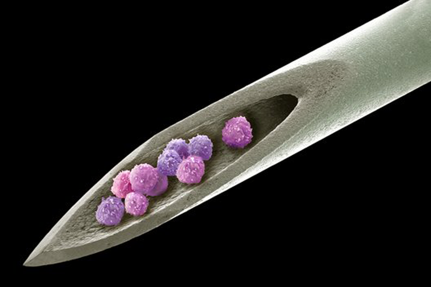 הטיפול בזקנה באמצעות תאי גזע הוא סוגיה מעניינת שחוקרים בוחנים כבר זמן מה. איור לשל מחט עם תאי גזע עליה | Steve Gschmeissner / Science Photo Library