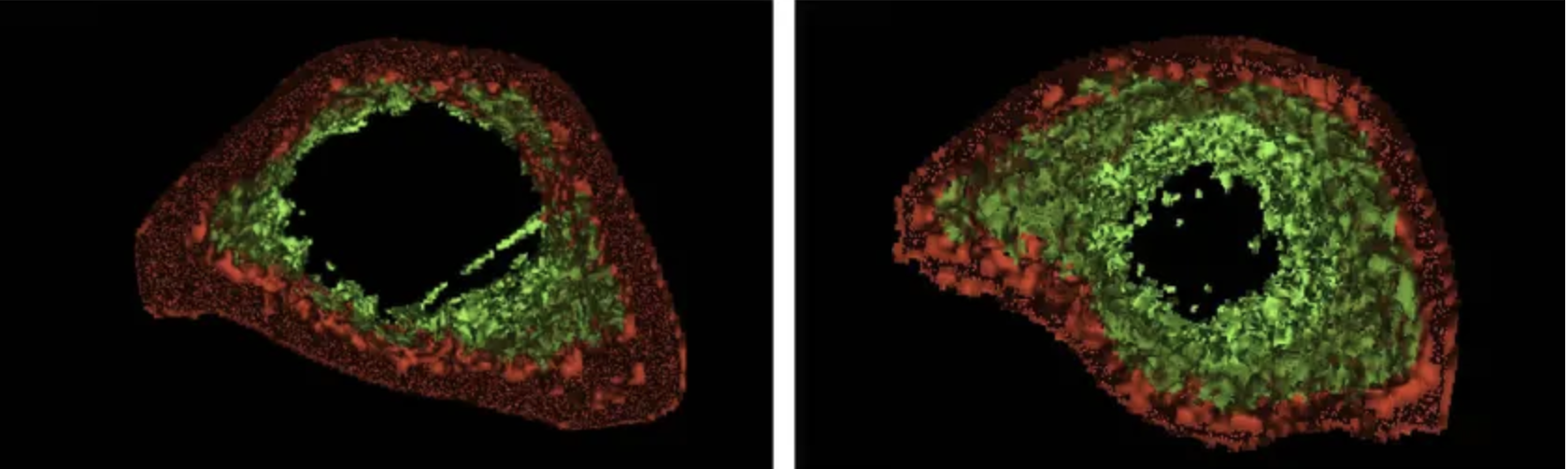 החוקרים בדקו שלל מדדים בריאותיים, ומצאו שבהיבטים רבים ניכר שיפור אצל הקופים שקיבלו את תאי הגזע המהונדסים. תמונה שמראה את מצב דלדול העצם (אוֹסְטֵאוֹפּוֹרוֹזִיס) אצל קופים בקבוצת הביקורת (משמאל) ובקבוצה המטופלת בתאים המהונדסים (מימין) | מתוך המאמר Lei et al 2025