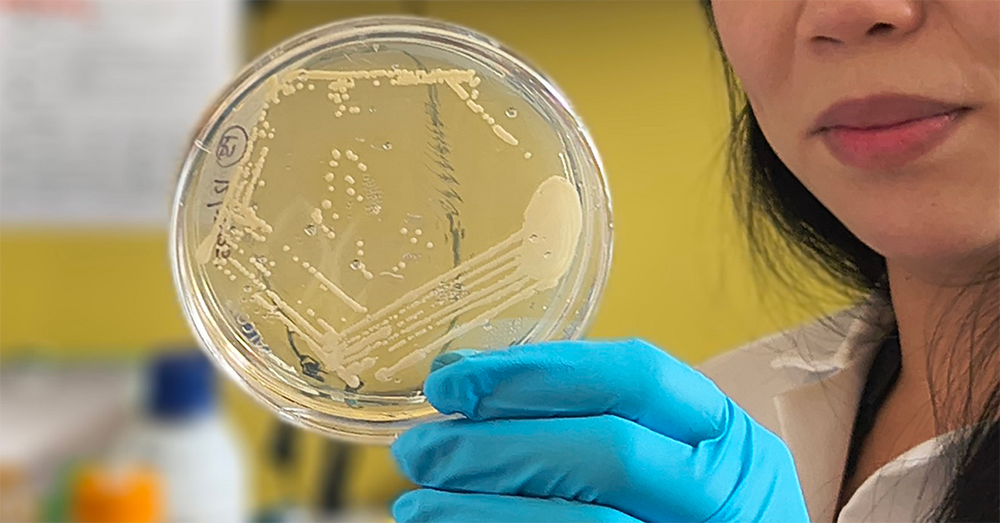 החוקרים דגימות צואה שנאספו מחולי התסמונת. החוקרת המובילה בוחנת תרבית חיידקי מעי מנבדק | UC San Diego Health Sciences