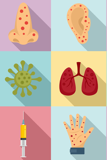 מחלות ללא גבולות: חצבת ועוד חצבת