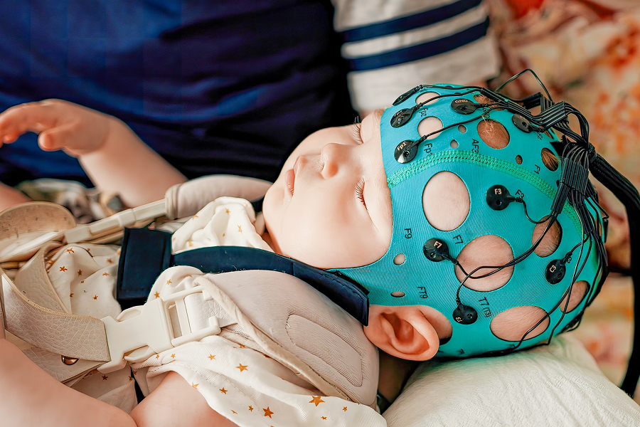 המחקר מצביע על קשר בין תפיסת ההכנסה של אנשים עניים לבין התפתחות המוח של תינוקות. תינוק עם אלקטרודות שמודדות את גלי המוח | Shutterstock, Anton Watman