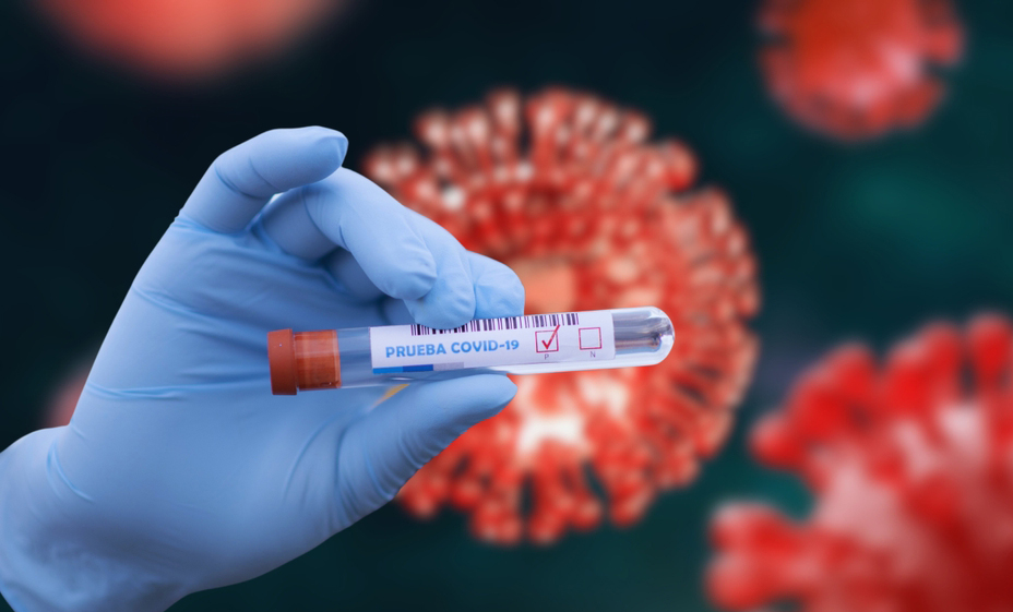 אומנם אין גל תחלואה, אך הקורונה איתנו כל העת, ויש רמות תחלואה יציבות גם כשאין גל ברור. נגיף Covid-19 במבחנה | moshka.com, Shutterstock