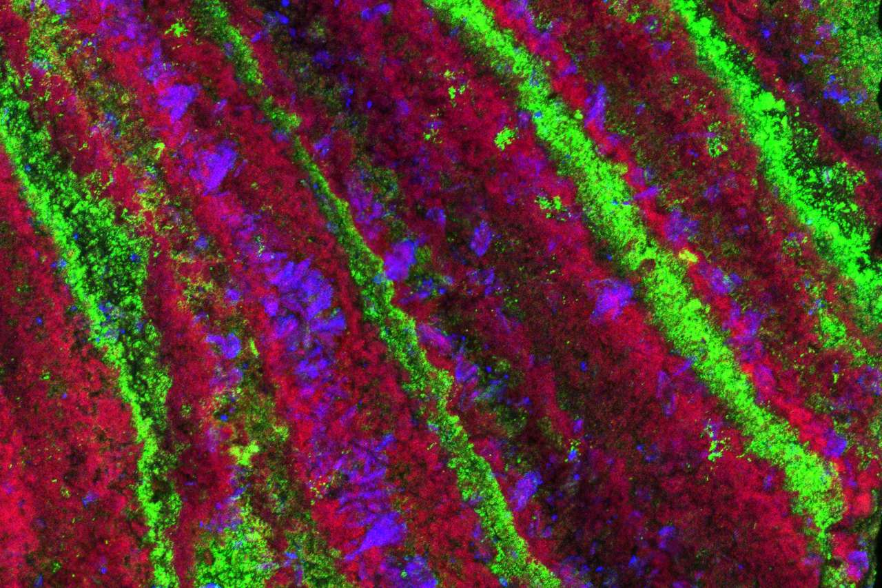 kidney-stone-bacteria-scotland: באמצעות שילוב של מיקרוסקופ אלקטרונים סורק וצביעת מעטפת הביופילם בצבע פלואורסצנטי זוהר, חשפו החוקרים כי החיידקים הם חלק בלתי נפרד מהשלד הפנימי של האבן. תמונת מיקרוסקופ של אחת האבנים, בירוק: שכבות הביופילם | UCLA