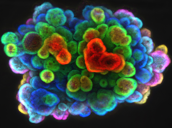 מבנה במעי של עכבר שגדל מאוד בעקבות השתקת החלבון ARTS ועיכוב האפופטוזה של תאי הגזע | צילום: אל קורן, הטכניון