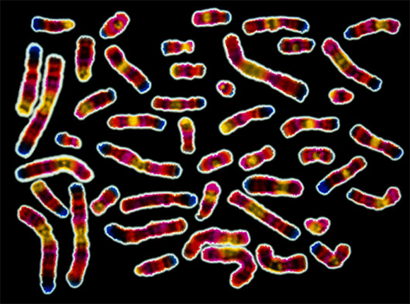 Human DNA molecules - the chromosomes | Scott Camazine, Science Photo Library